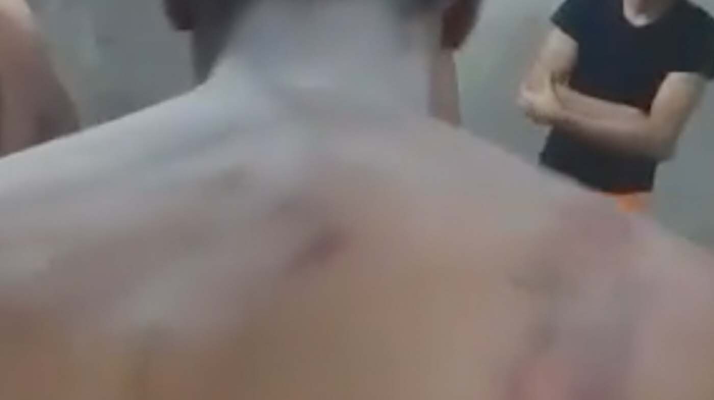 A screenshot of footage from al-Salam police station shows bruises on a detainee's back (MEE)