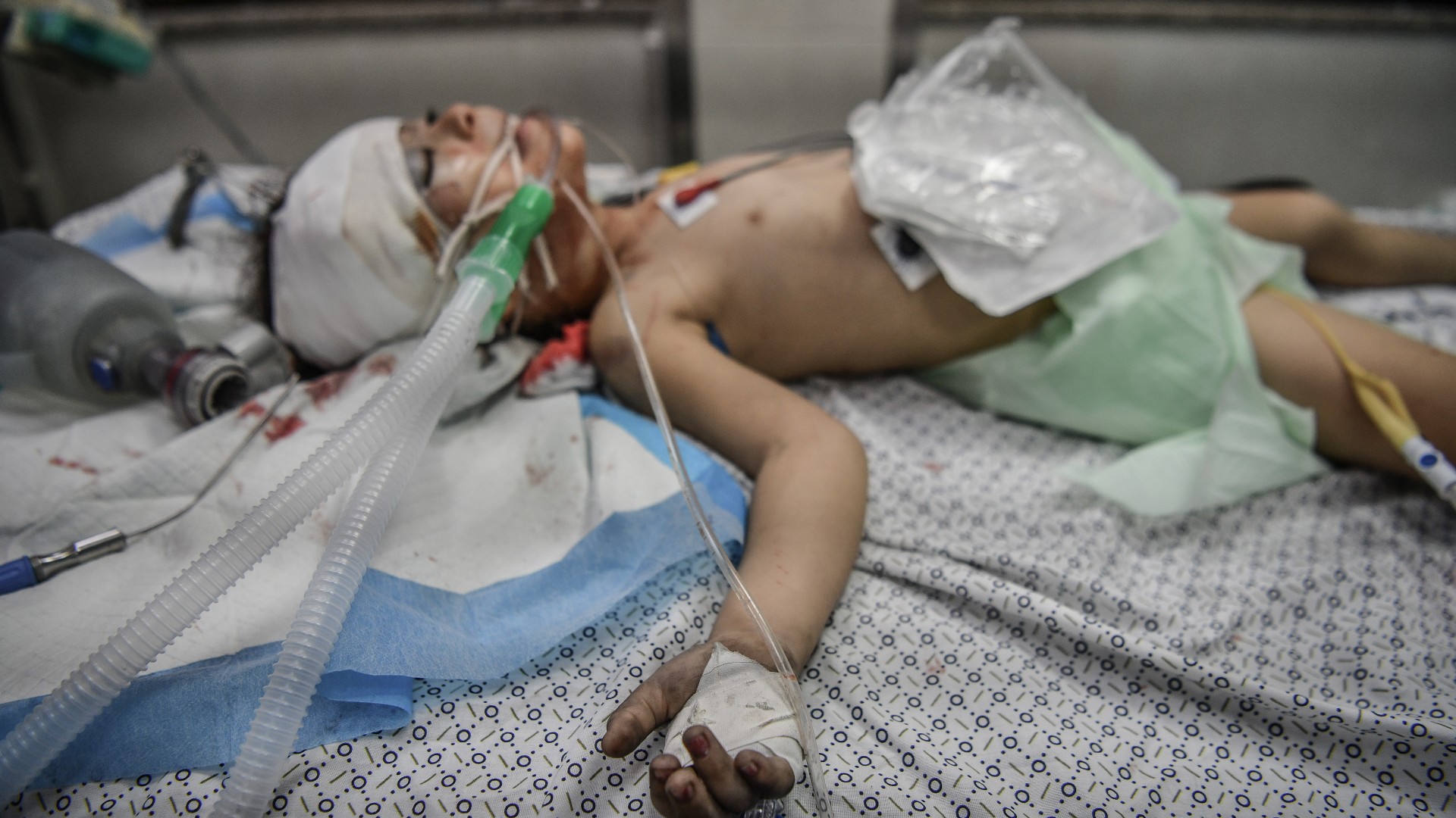 A Palestinian child injured by Israeli airstrikes on Gaza on 13 October, 2023 (Reuters)