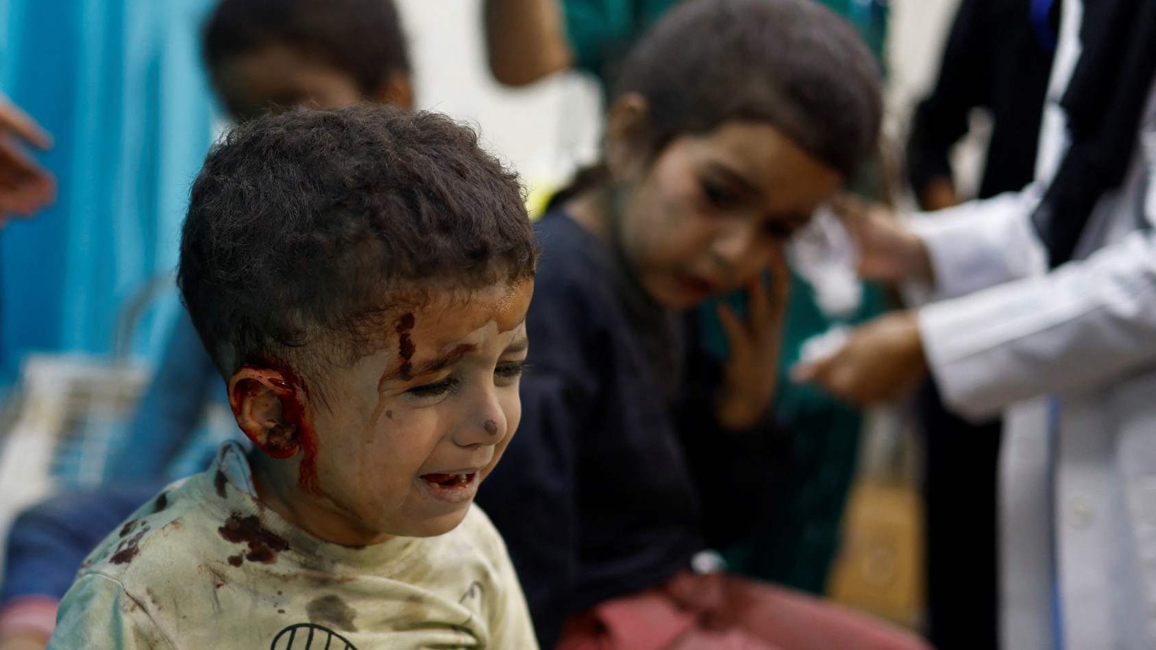 Palestinian children wounded in Israeli strikes amid the ongoing conflict between Israel and Palestinian group Hamas wait to receive treatment at Nasser hospital in Khan Younis in the southern Gaza Strip November 12, 2023