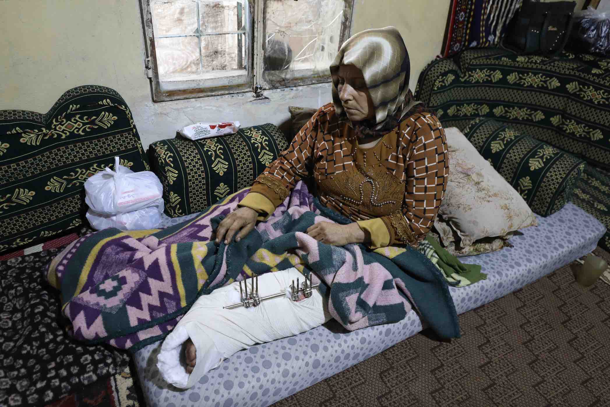 The wife of Ahmed Qasoum resting her broken leg after being injured in a US attack near Idlib on 3 December (MEE/Izzeddin Kasim)
