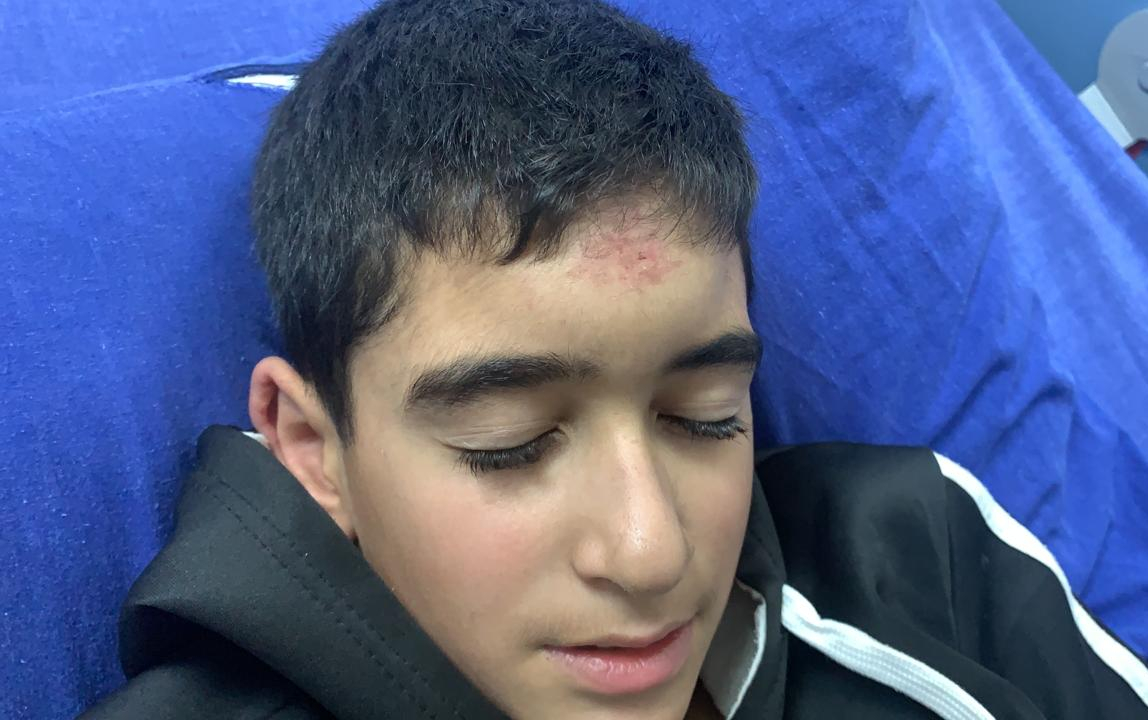 Muhammad, who is now being treated at the H-Clinic in Ramallah, said 'I started crying and screaming, until a Palestinian came and pulled me out' (MEE)
