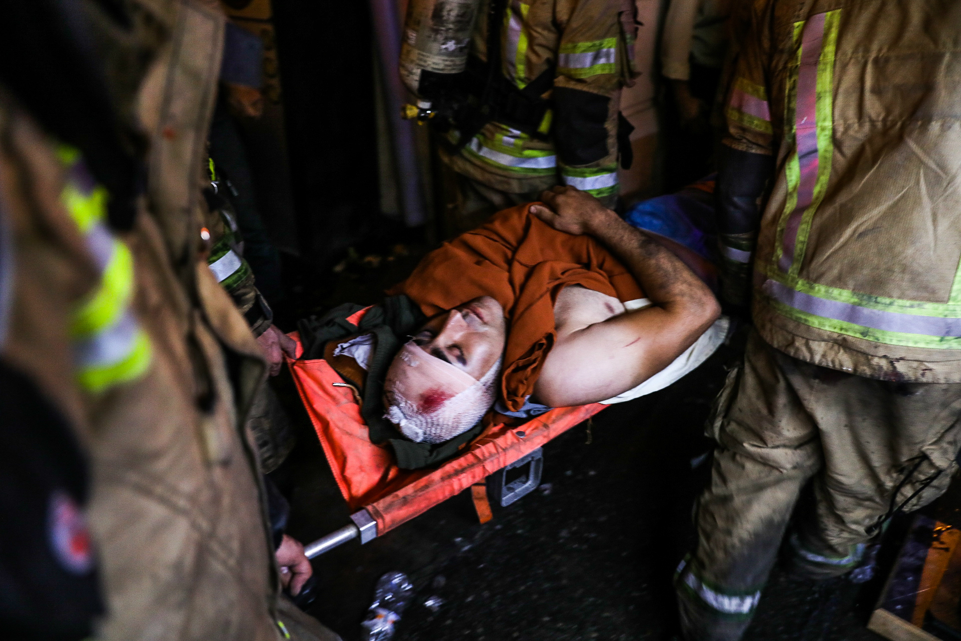 First responders carry away an injured person on a stretcher at the scene of an explosion (AFP)