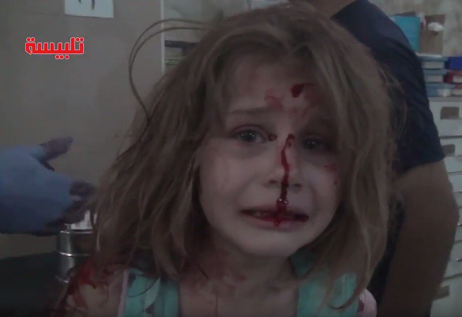 Ayah was taken to hospital after a Syrian government air strike reportedly ...
