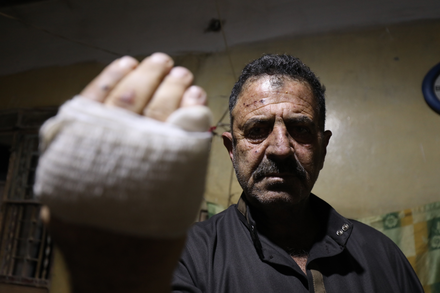 Ahmed Qasoum lève sa main, blessée par des éclats d’obus qui ont traversé sa voiture le 3 décembre près d’Idleb (MEE/Izzeddin Kasim)