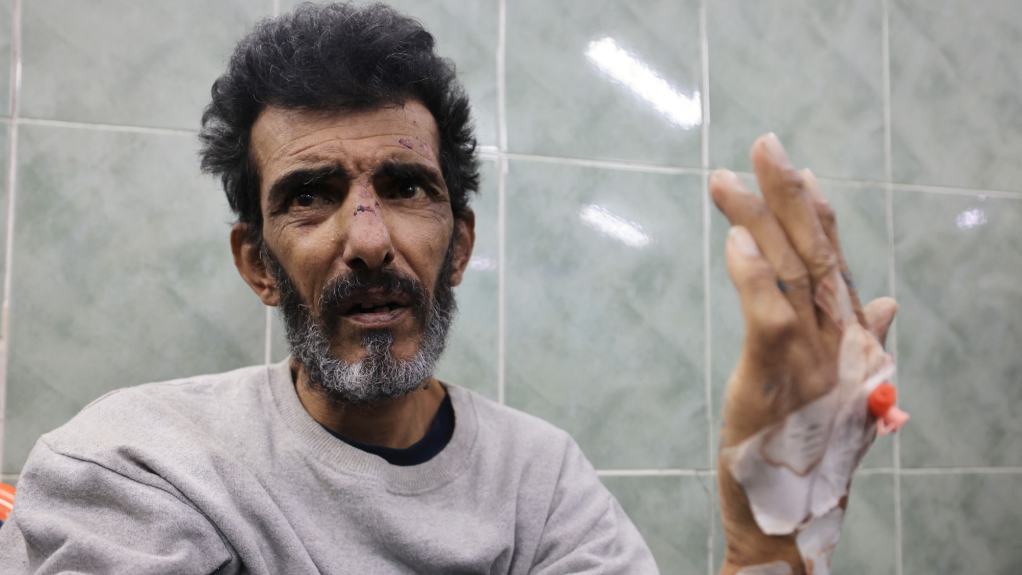 A Palestinian man receives treatment Rafah's Al-Najjar hospital after being released by Israeli forces on 12 January 2024 (AFP/Mahmud Hams)