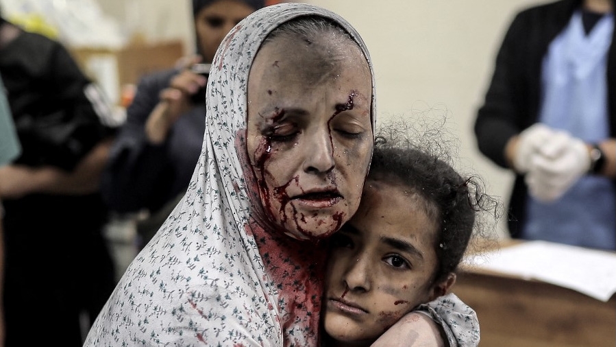 An injured Palestinian woman hugs an injured girl child in hospital following the Israeli bombardment of Khan Younis in the Gaza Strip on 15 November 2023 (AFP)