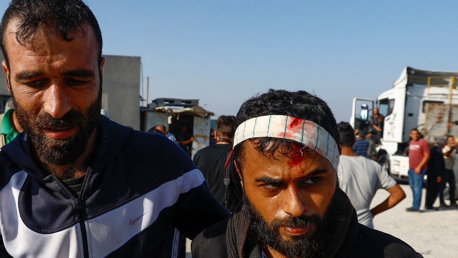 A Palestinian labourer  who was in Israel during the Hamas October 7 attack and said that he was beaten on his head by Israeli forces, arrives at the Rafah border in the southern Gaza Strip, 3 November 2023 (Reuters)