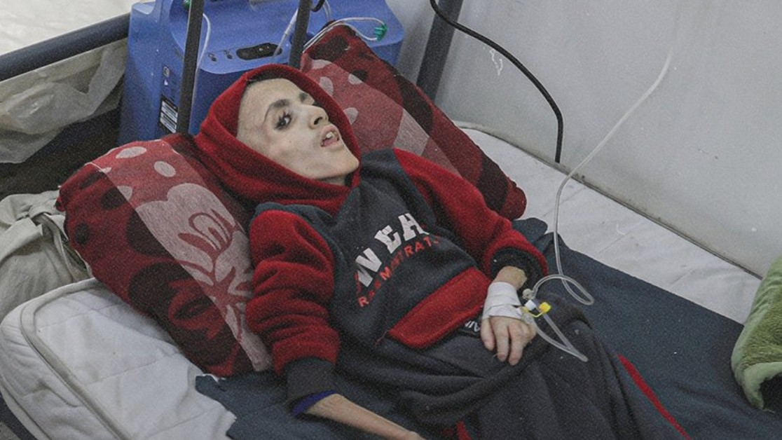 Yazan al-Kafarna, le visage de la famine qui tue les enfants de Gaza | Middle East Eye édition française
